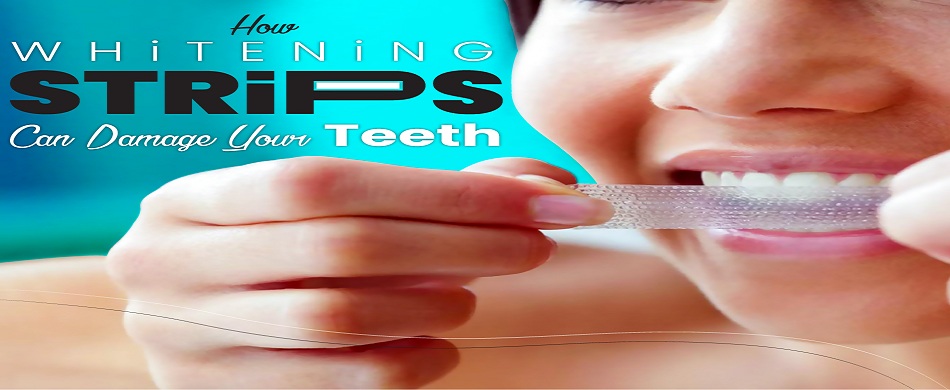 Whitening Strips teeth